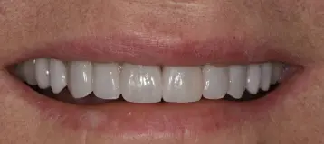 Richard S. Bernstein DDS
