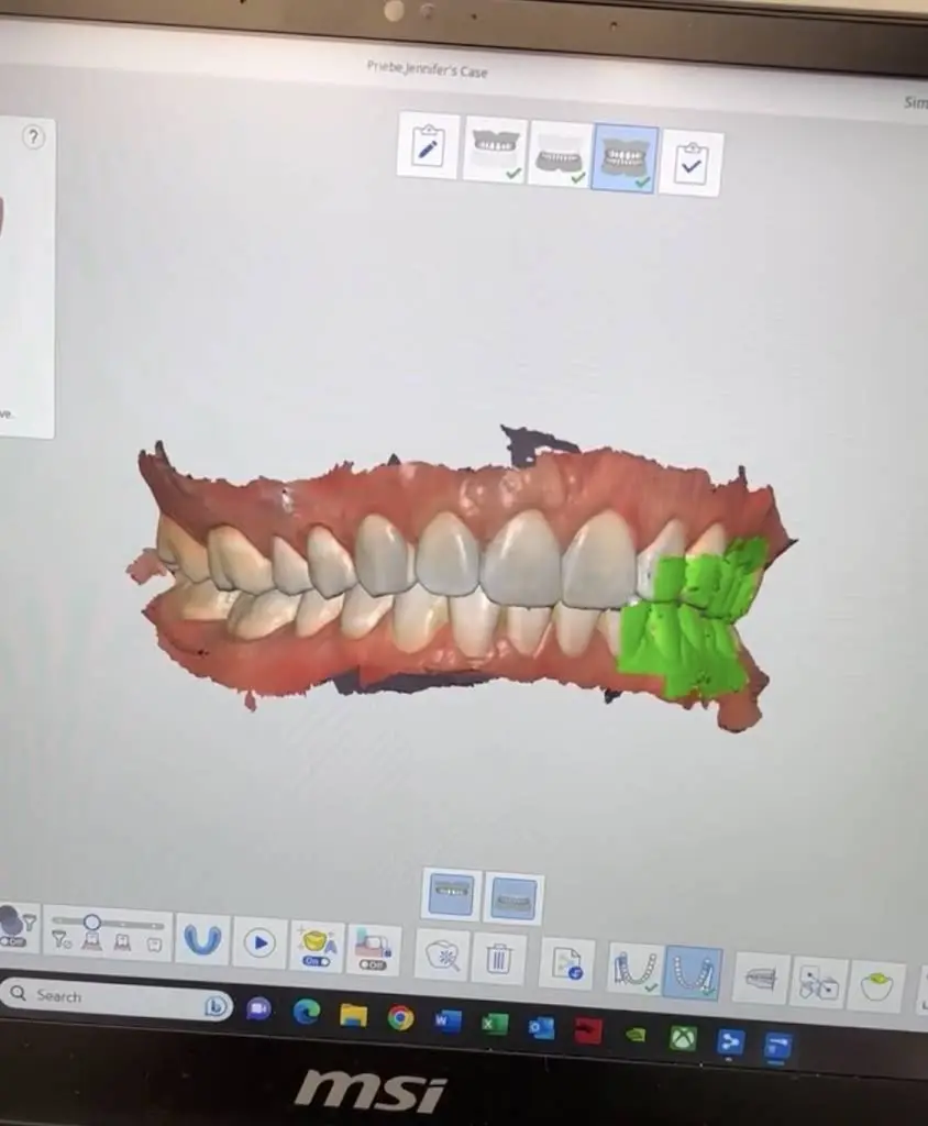 Prosthodontic & Implant Consultants, Drs. Priebe, Wiens, & Riedy