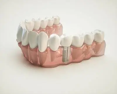 Family Smiles Dental Care