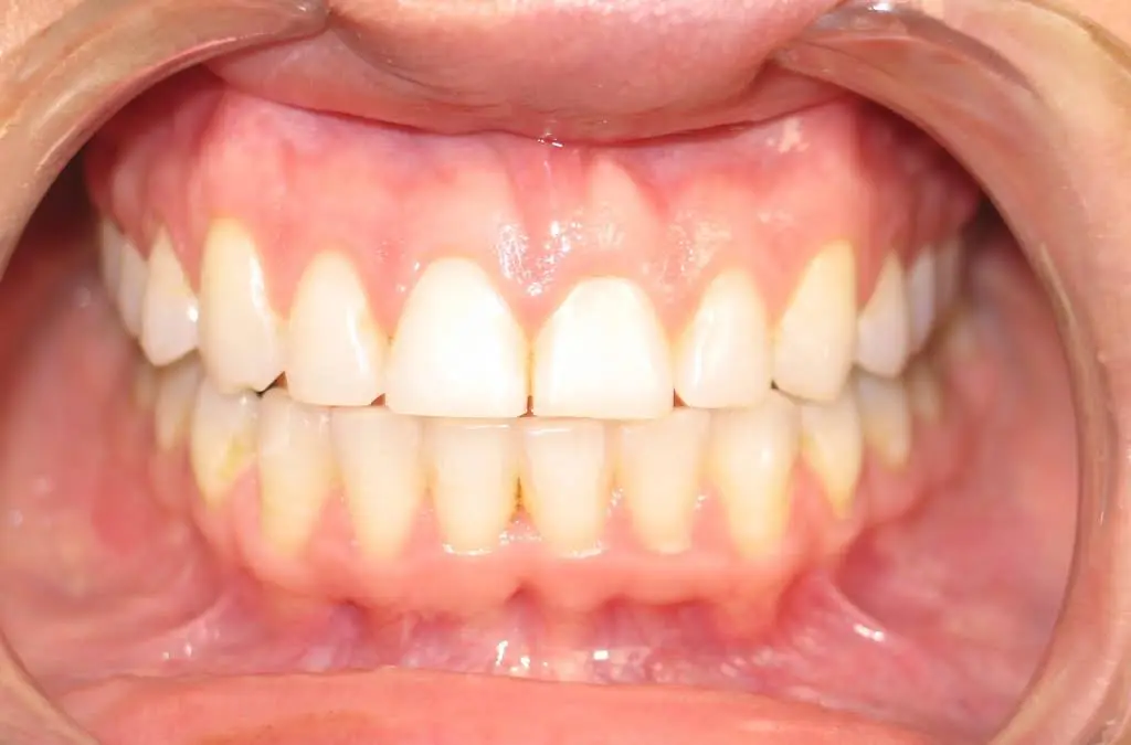 Smile Arts Dentistry