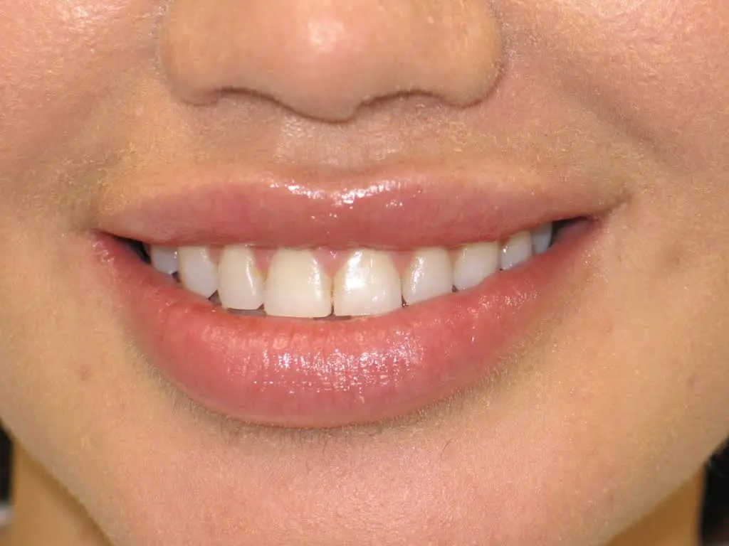 Smile Arts Dentistry