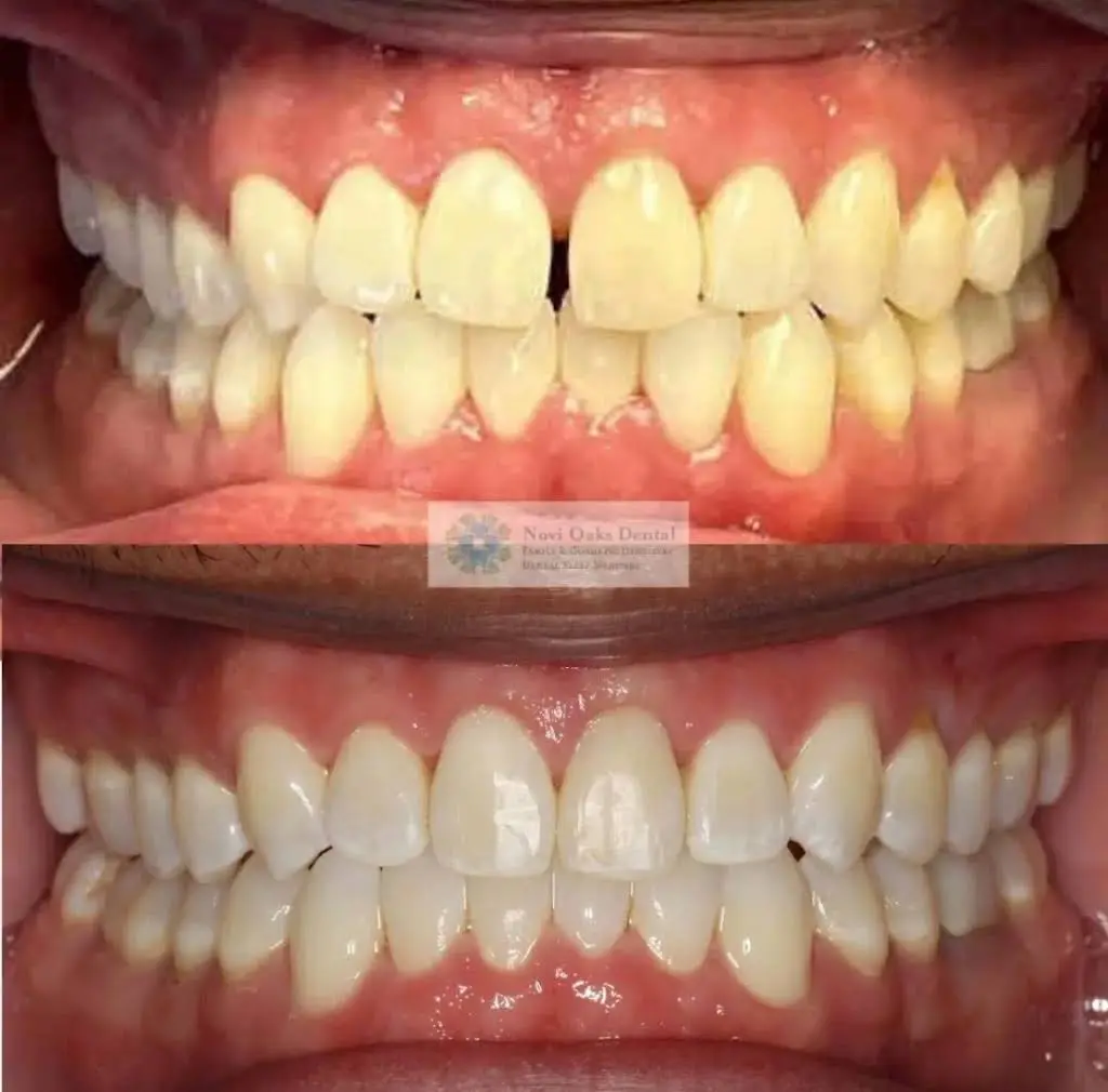 Novi Oaks Dental