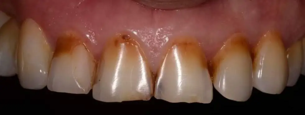 Smiline Dental