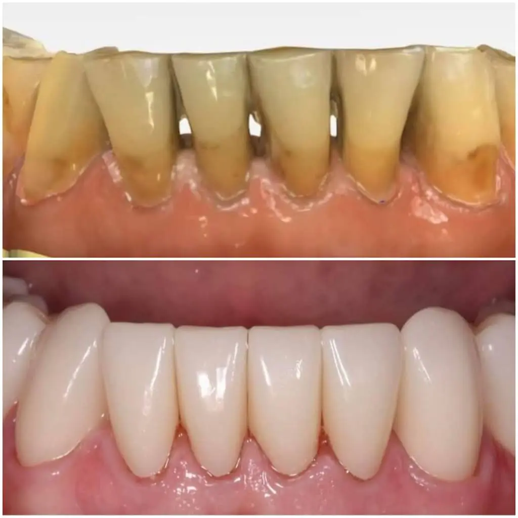 Smiline Dental