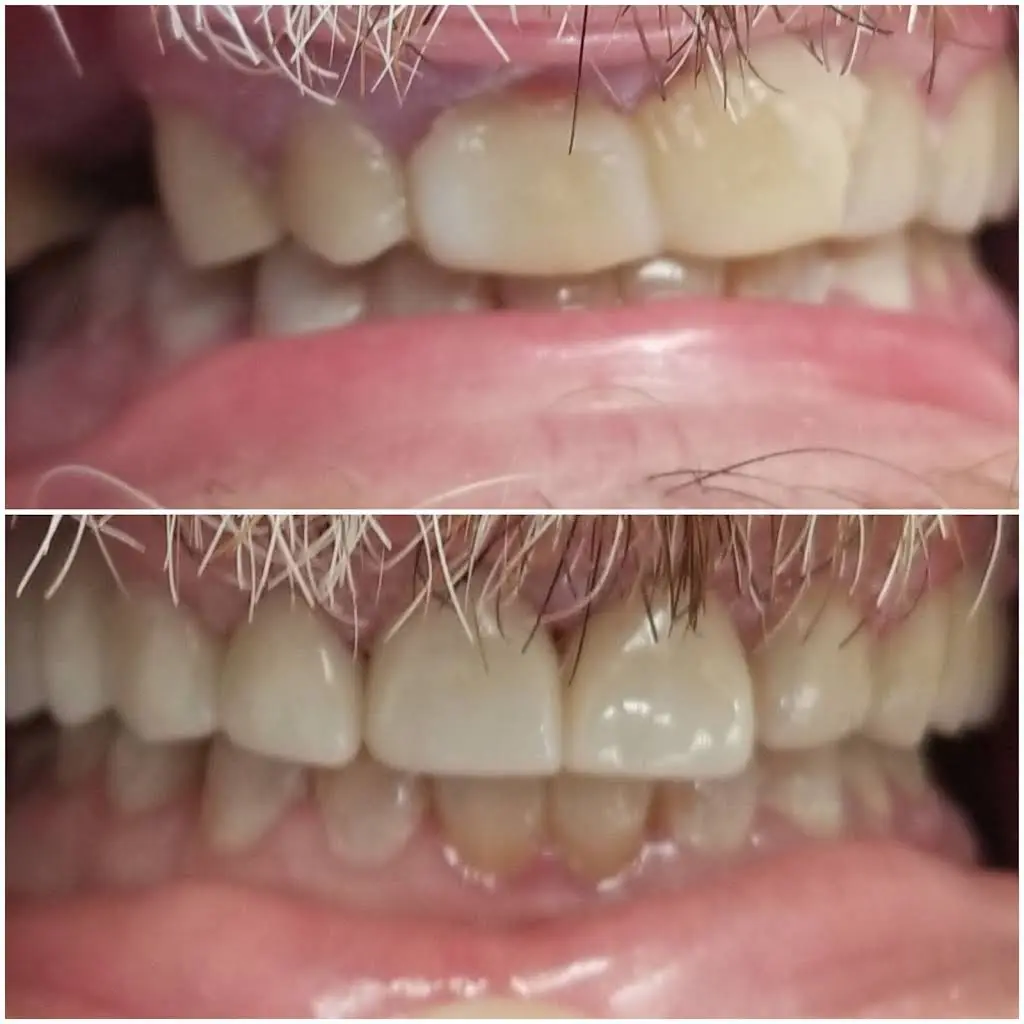 Smiline Dental
