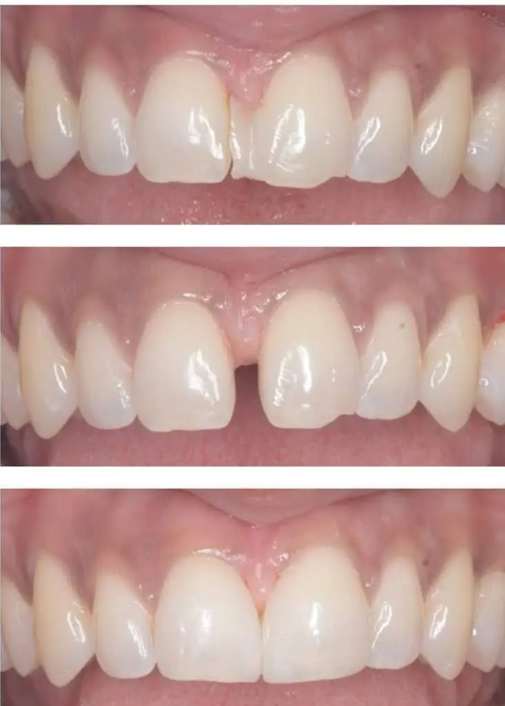 Smiline Dental