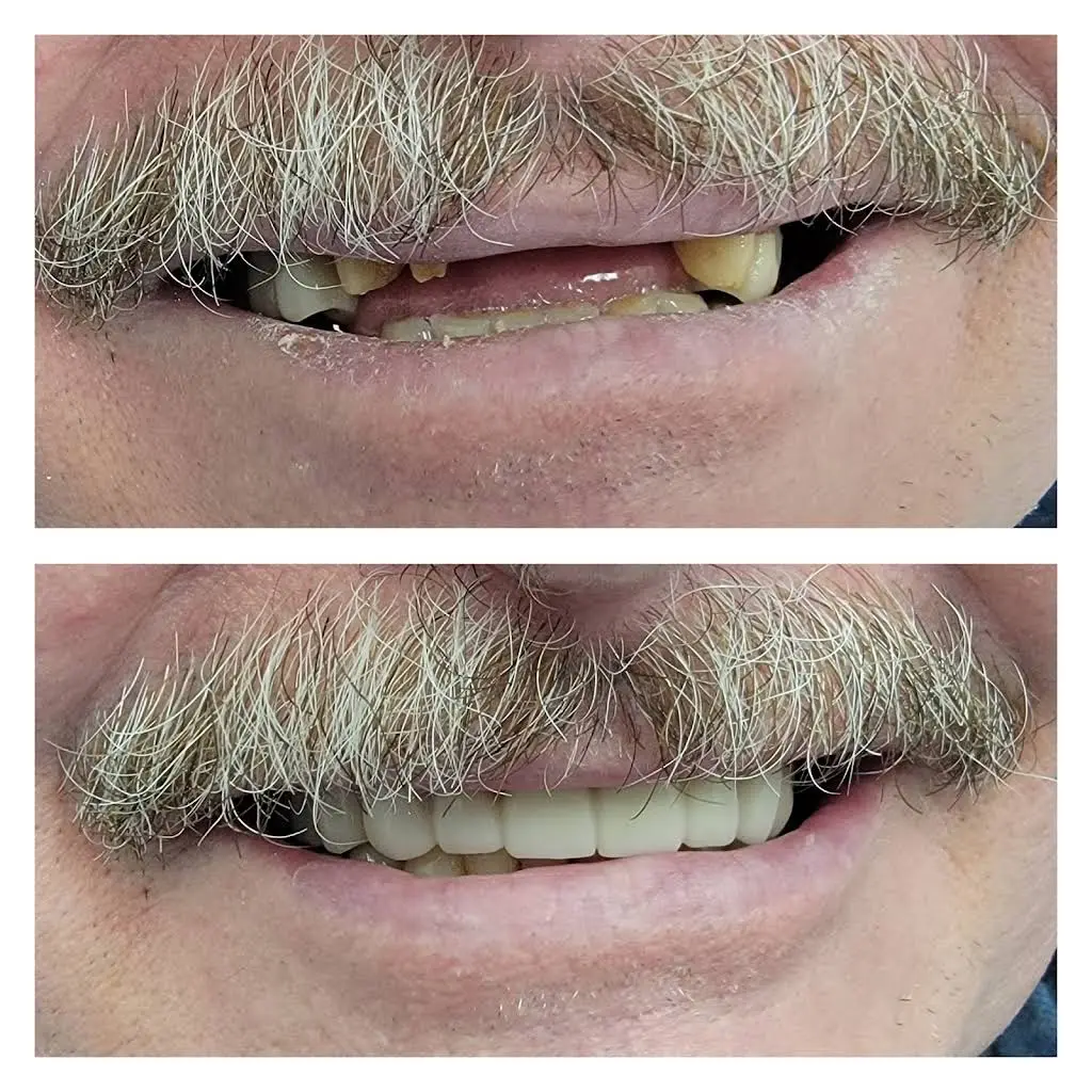 Smiline Dental