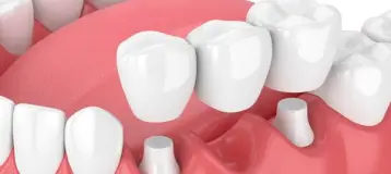 Enhance Family Dental