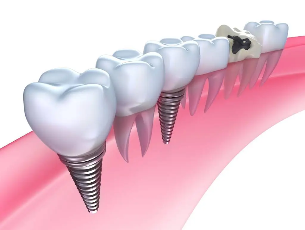 Buscemi Family Dentistry