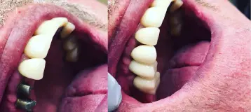 Troy Smiles: Cosmetic and Implant Dentistry