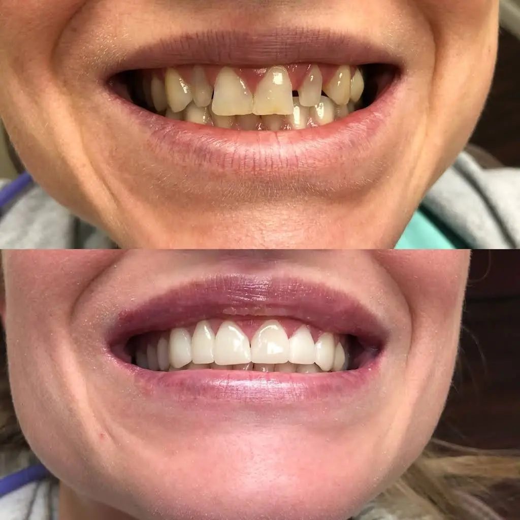 Troy Smiles: Cosmetic and Implant Dentistry