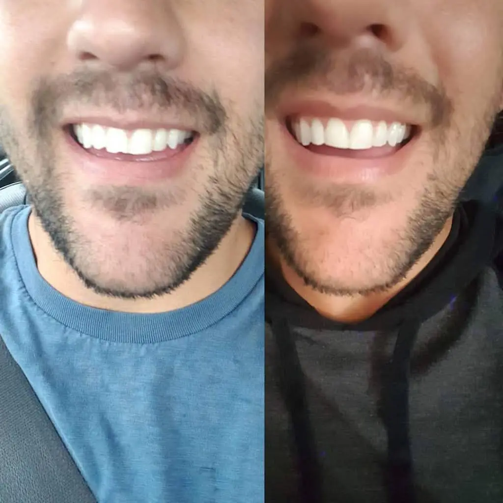 Troy Smiles: Cosmetic and Implant Dentistry