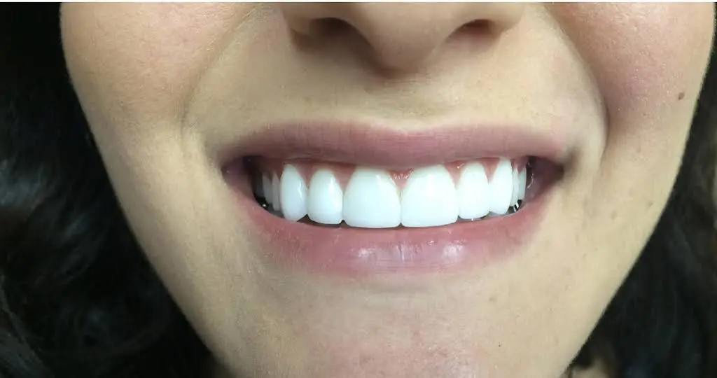 Family Dental Center PC