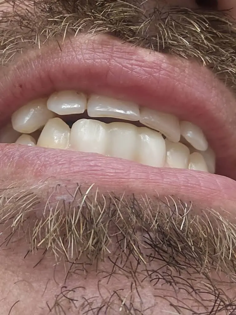 Laser Family Dental / Dental Implant Center of MI