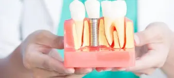 Hamburg Family Dental