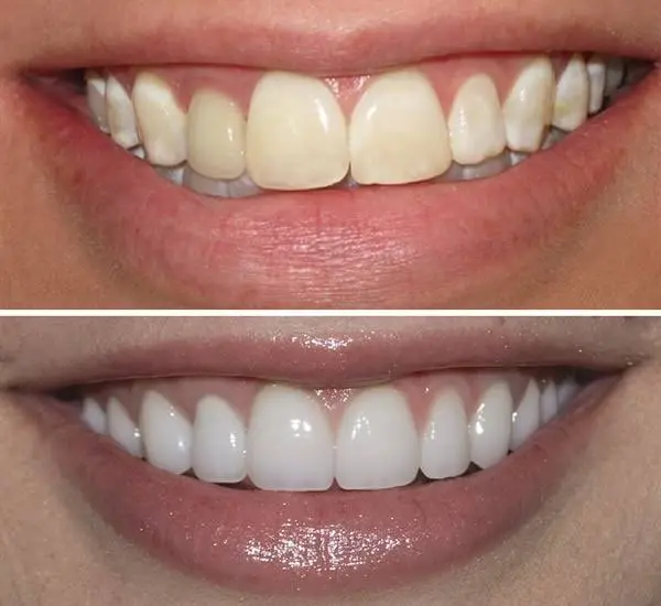 Desai Dental Spa, PC
