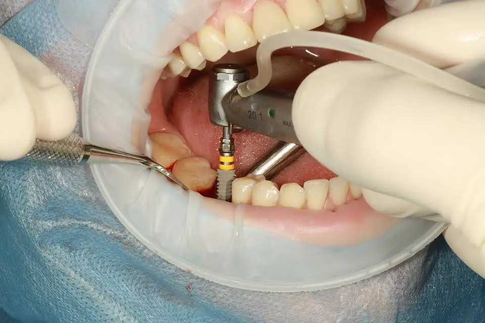 Oral and Facial Surgeons of Michigan