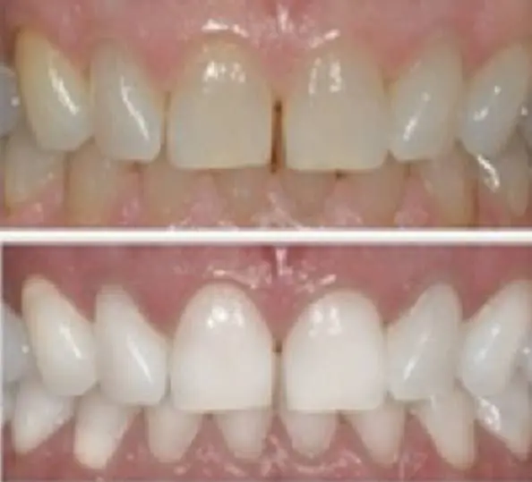 Dental First