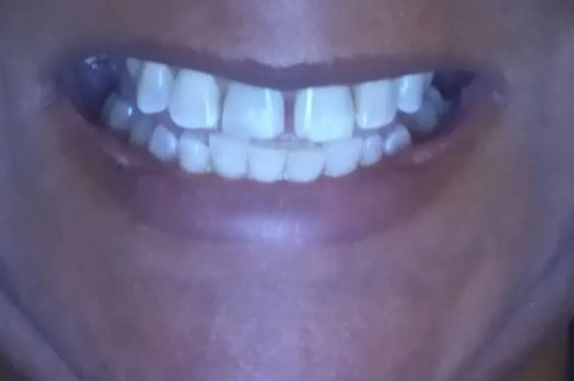 Ultimate Smiles