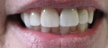 Northville Smiles