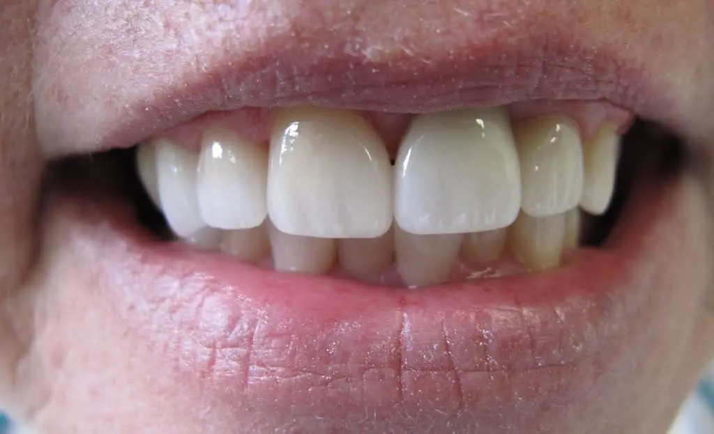Northville Smiles