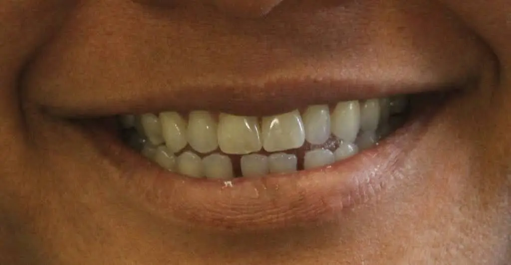 Northville Smiles
