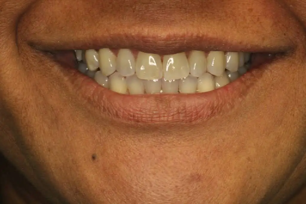 Northville Smiles