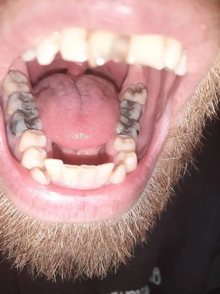 My Community Dental Centers ~ Howell