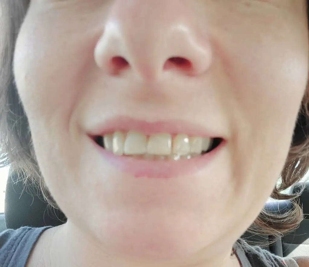 My Community Dental Centers ~ Howell