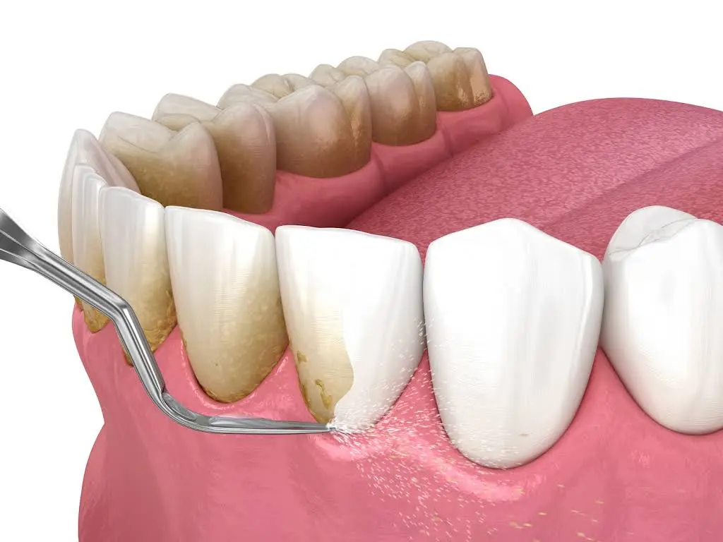 Strathroy Family Dental