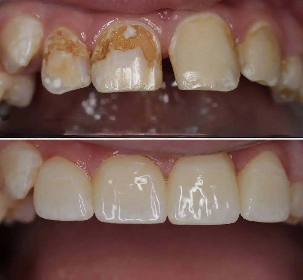 Macomb Dental Group