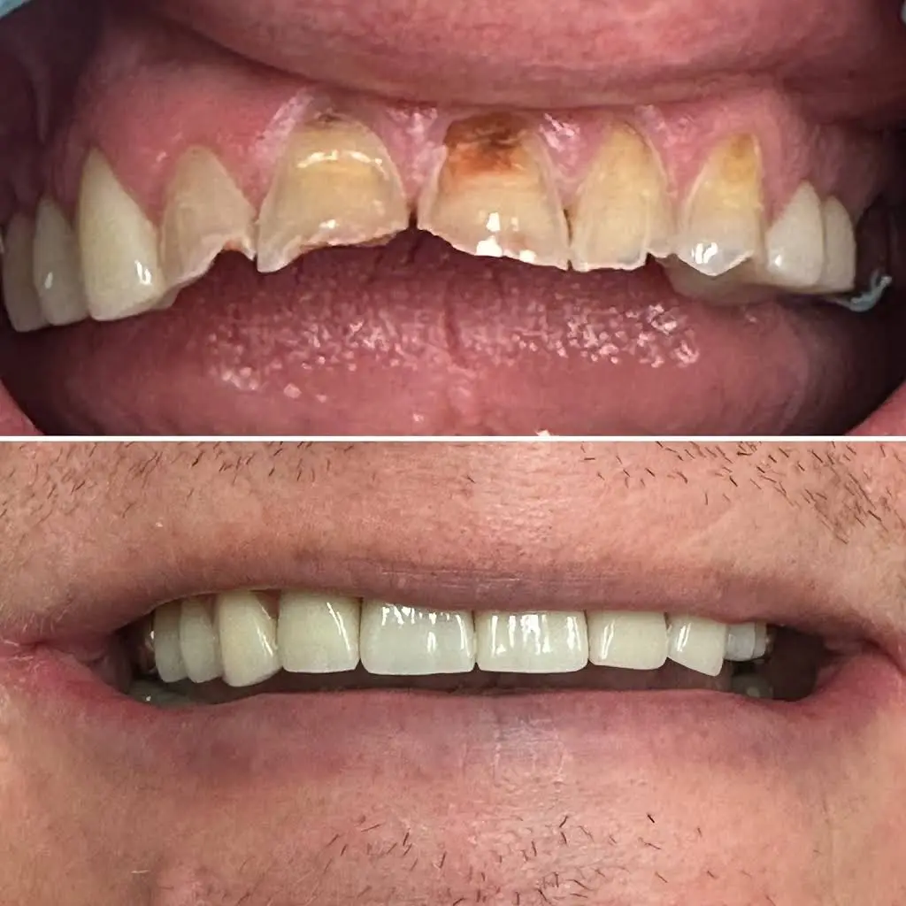 Macomb Dental Group