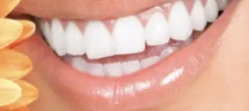 Bright Smile Dentistry - Dr. Rassam-Zora