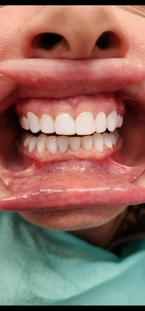 Bright Smile Dentistry - Dr. Rassam-Zora