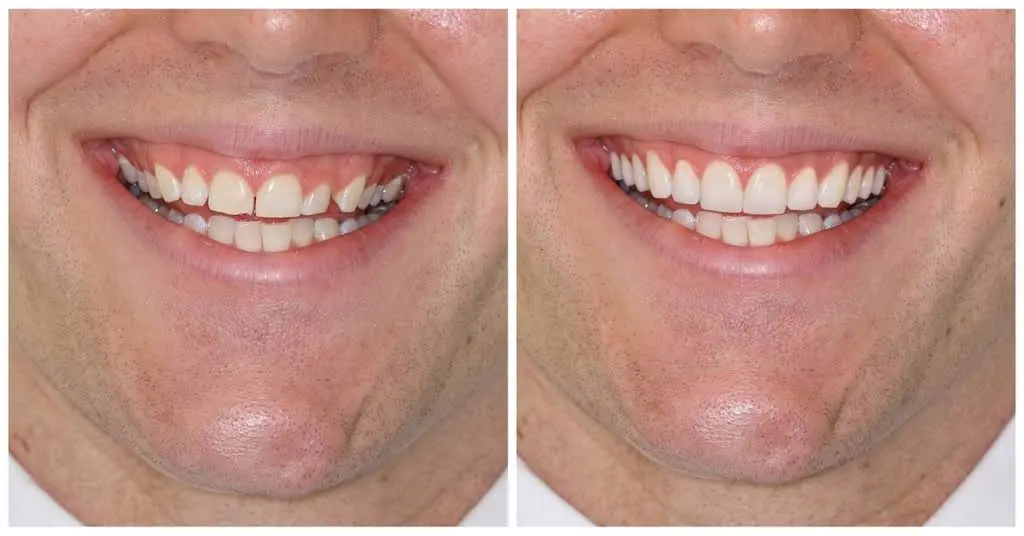 Bright Smile Dentistry - Dr. Rassam-Zora