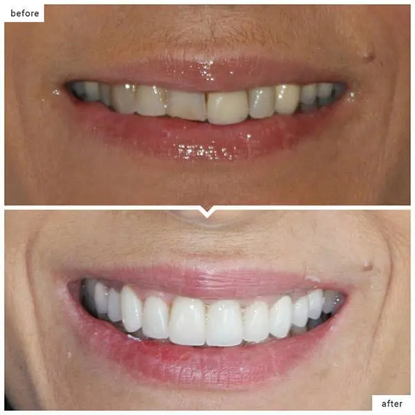 Bright Smile Dentistry - Dr. Rassam-Zora