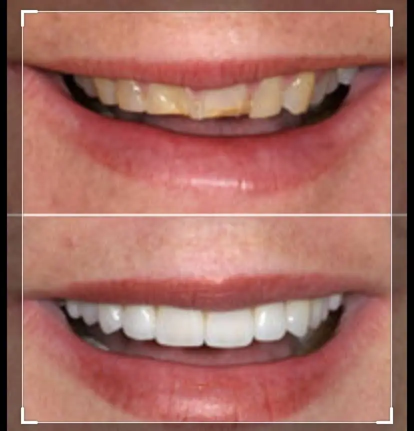 Bright Smile Dentistry - Dr. Rassam-Zora