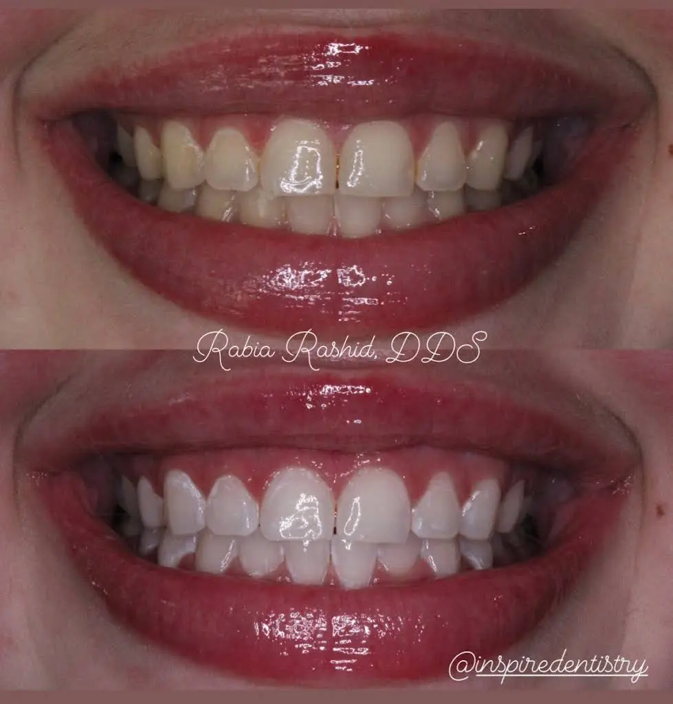 Inspire Dentistry