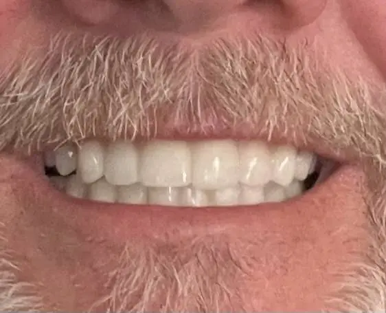 Dental Implant Center Of Royal Oak