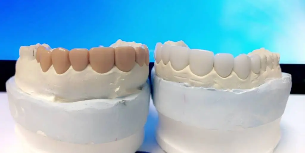 Dhillon Dental Care