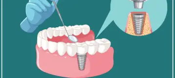 Dental 1 Care
