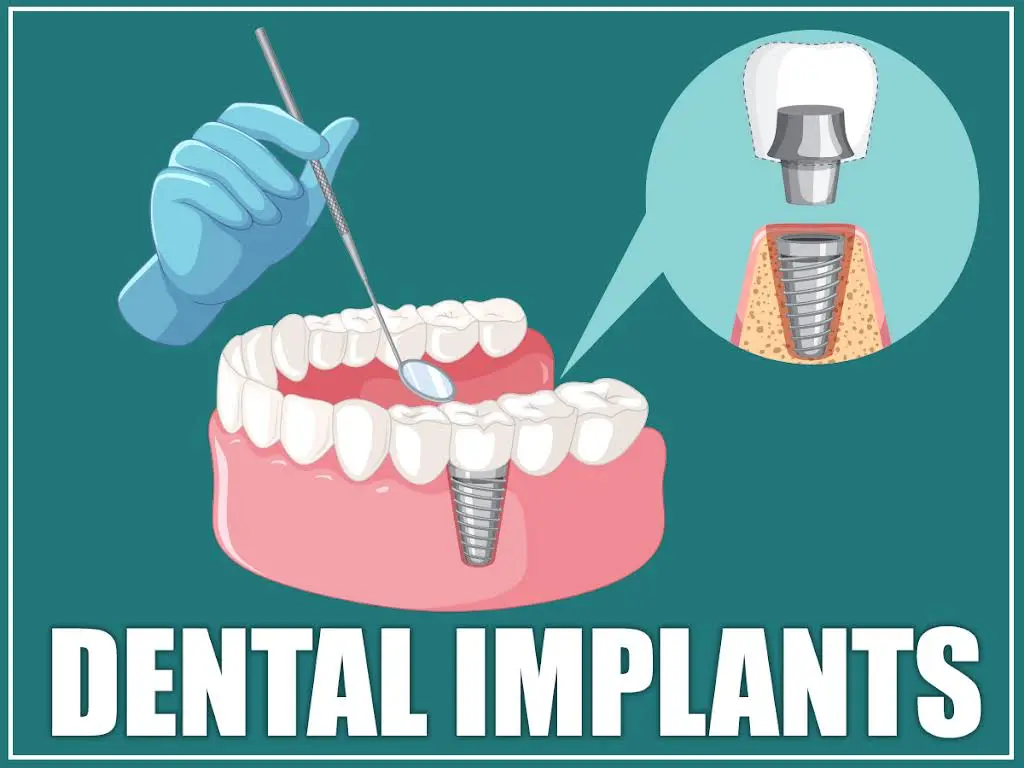 Dental 1 Care