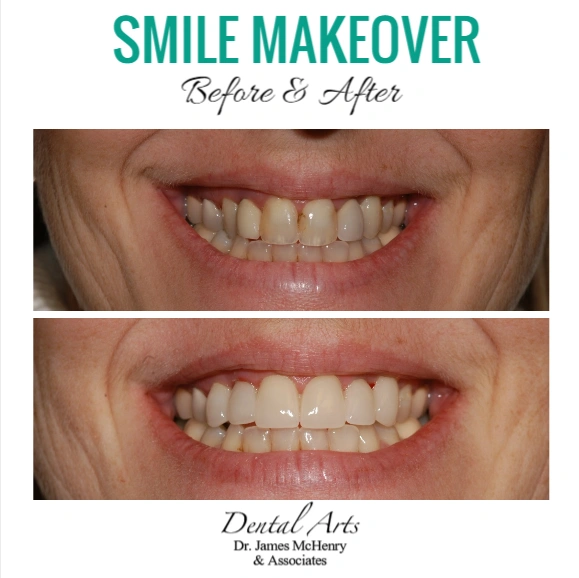 Dental Arts / Premier Smiles