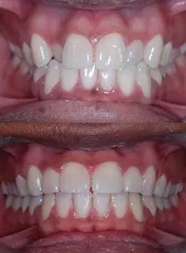Plymouth Dental Excellence