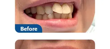 New You Dental Center