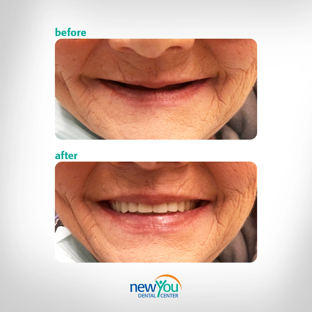 New You Dental Center