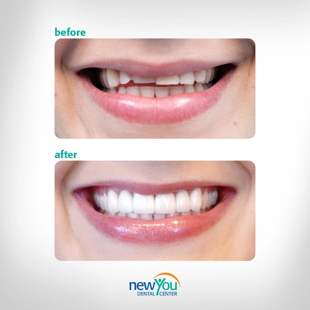 New You Dental Center