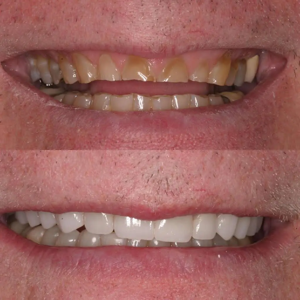 Uppleger Dental