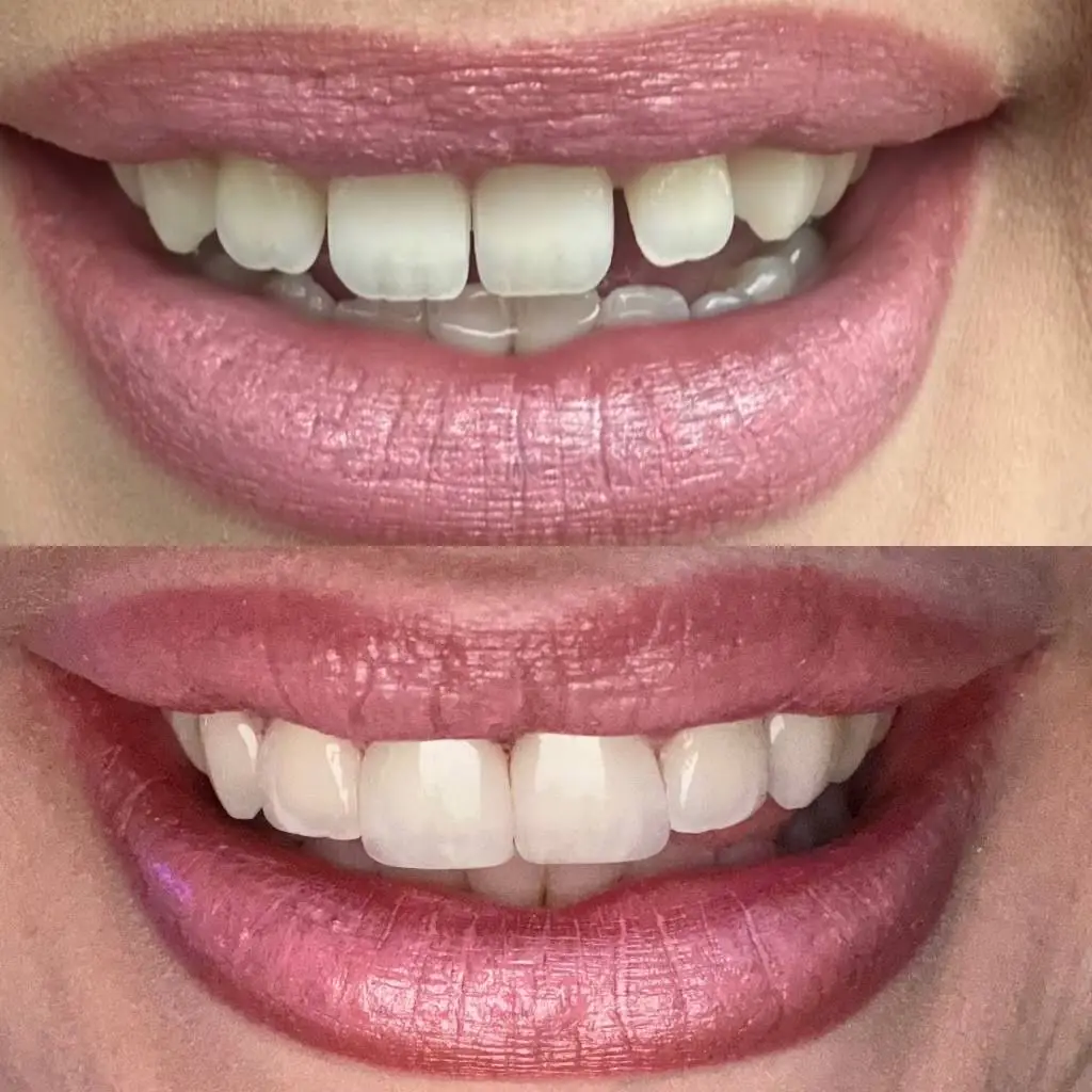 Uppleger Dental