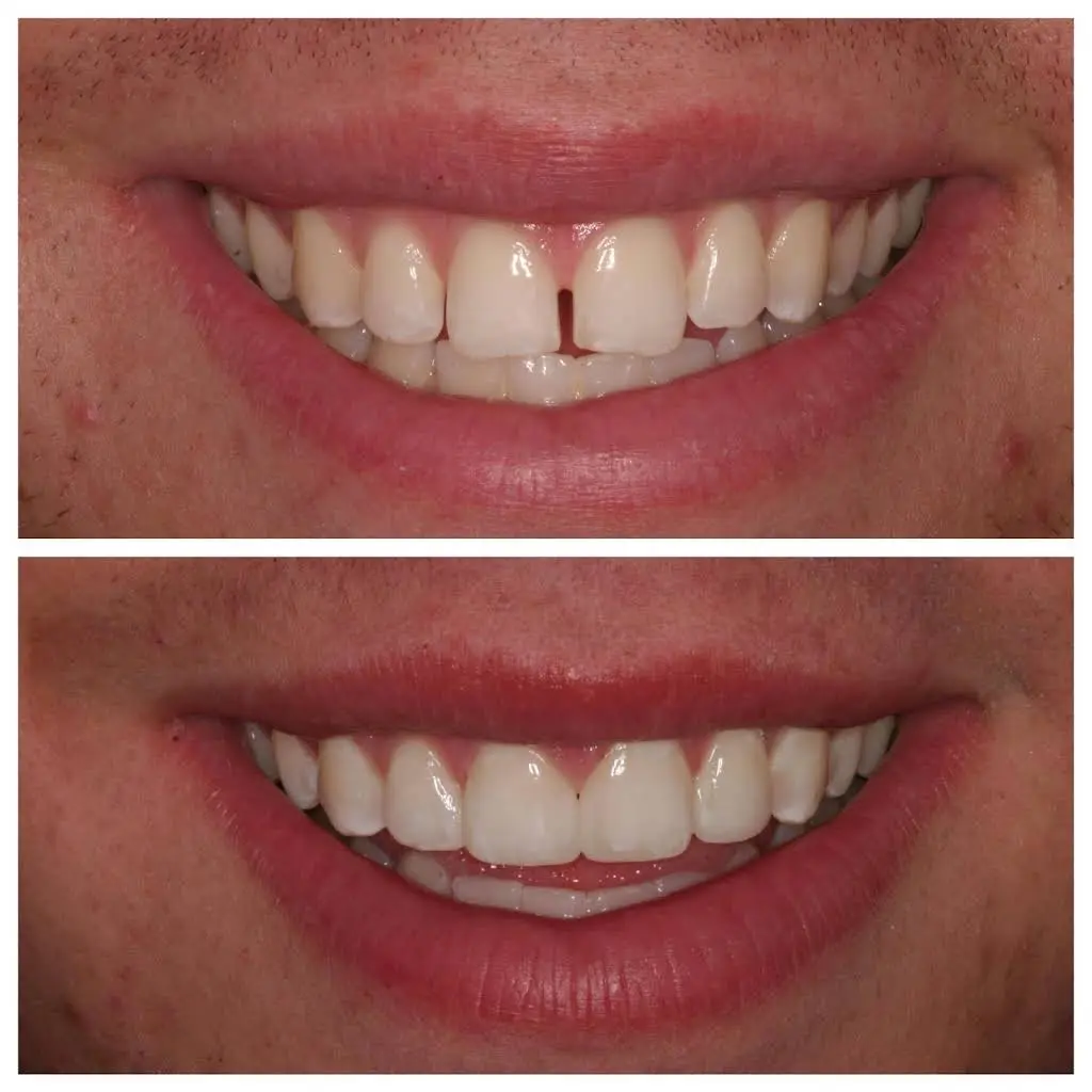 Uppleger Dental